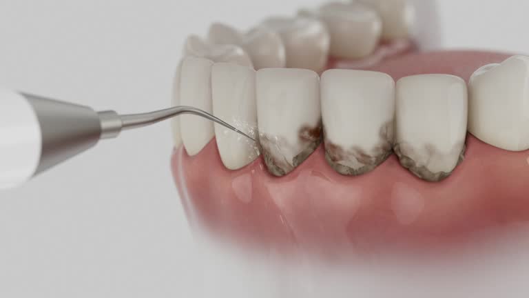 Trusted Invisalign Clear Aligners service in Chetopa, KS - Dentist Open Now